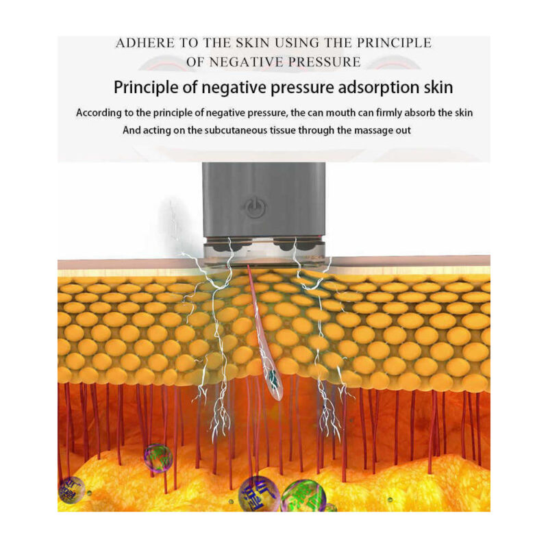 Επαναφορτιζομενές ηλεκτρικές βεντούζες για  μασάζ με ηλεκτρομαγνητικούς παλμούς - Image 3