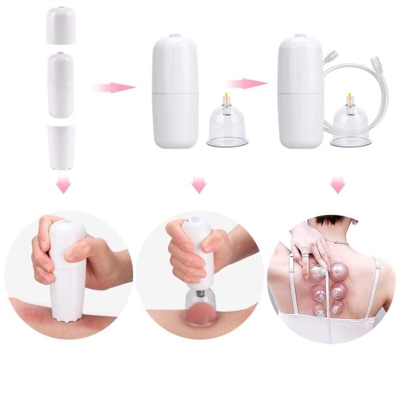 Ηλεκτρικό Σετ Με 12 Βεντούζες