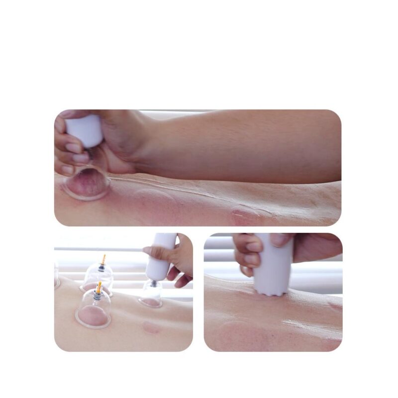 SMART CUPPING AND SCRAPPING DEVICE (2)