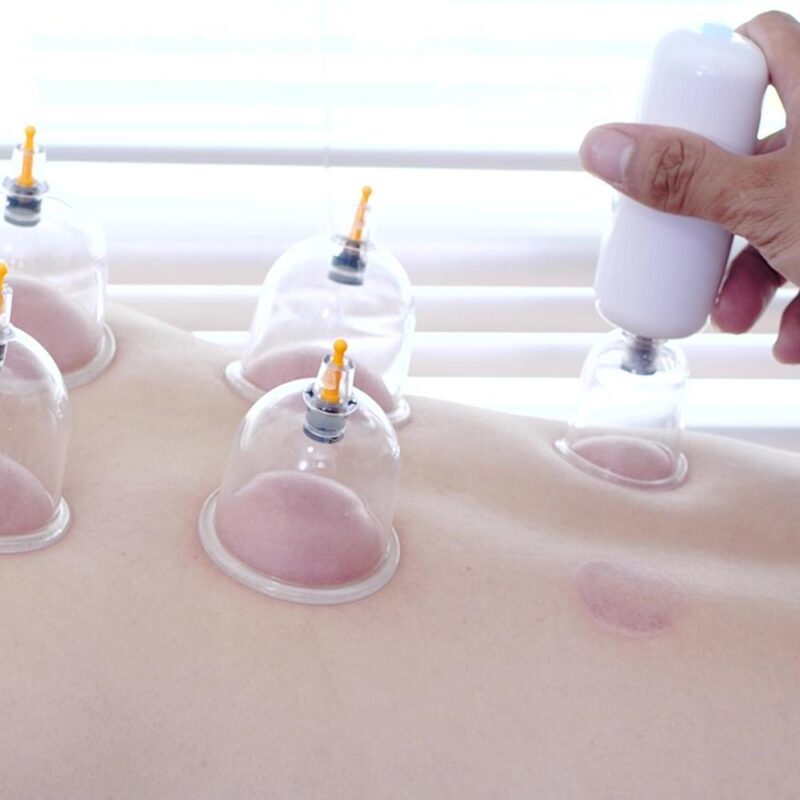 SMART CUPPING AND SCRAPPING DEVICE (6)
